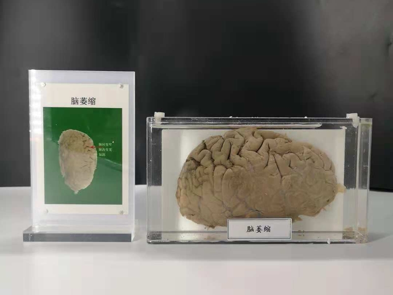 人動物病體大體標本