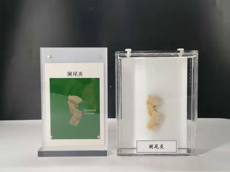 人動物病體大體標本