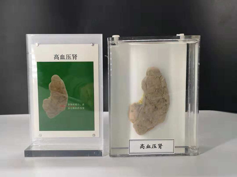 人動物病體大體標本
